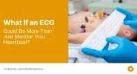 What If an ECG Could Do More Than Just Monitor Your Heartbeat_